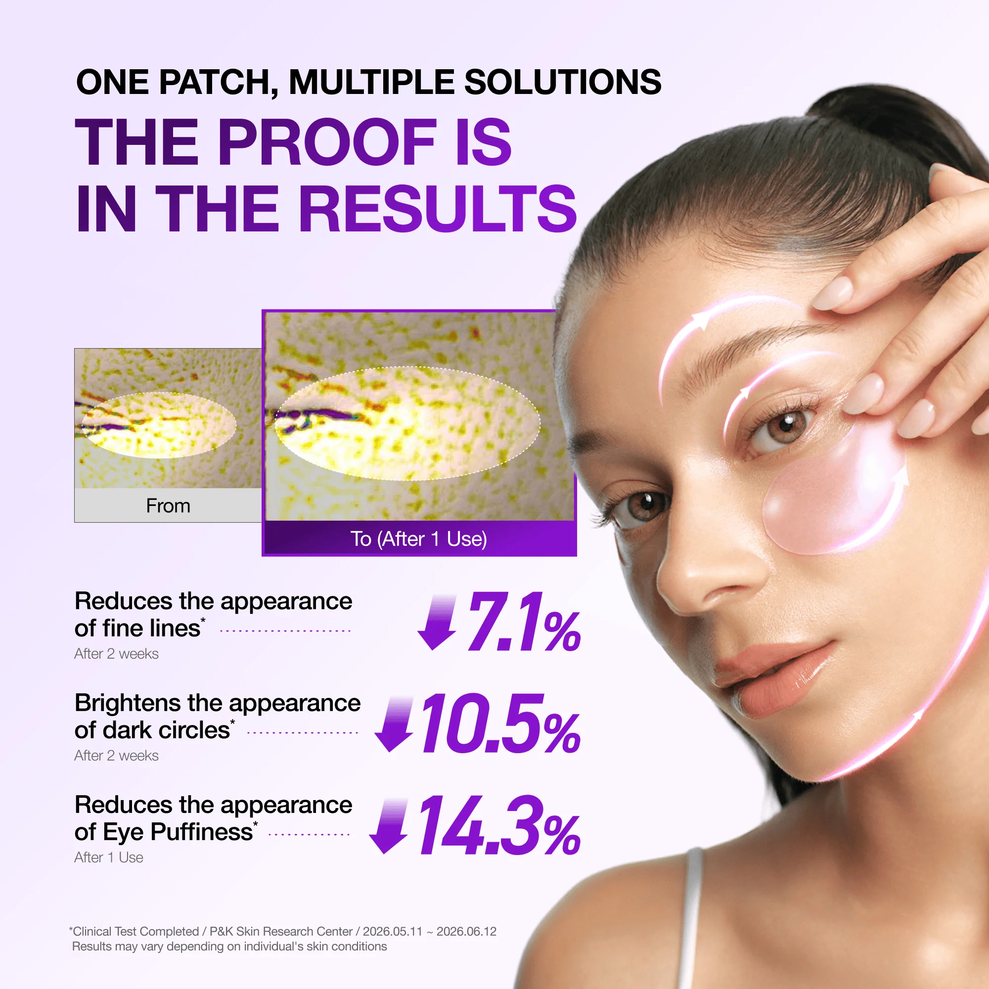 Anua US Spot Patches Retinol Berry Revitalizing Eye Patch